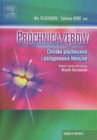 Próchnica zębów