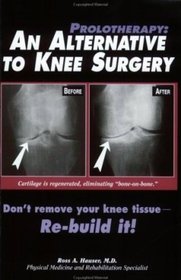 Prolotherapy
