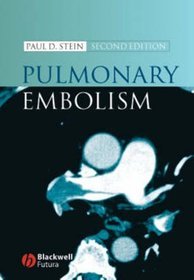 Pulmonary Embolism