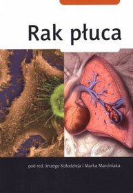 Rak płuca