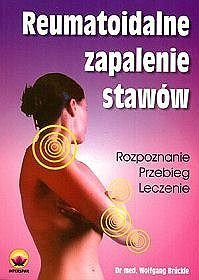 Reumatoidalne zapalenie stawów