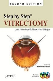 Step by Step: Vitrectomy (+DVD)