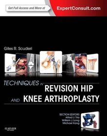 Techniques in Revision Hip and Knee Arthroplasty