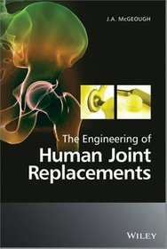 The Engineering of Human Joint Replacements