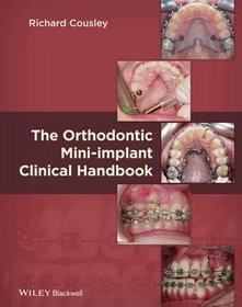 The Orthodontic Mini-Implant Clinical Handbook