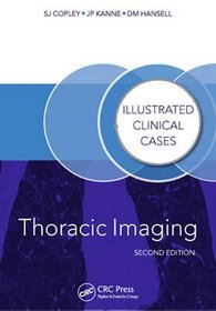 Thoracic Imaging