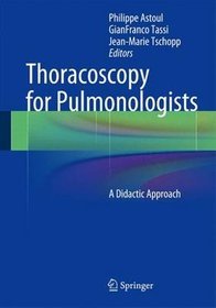 Thoracoscopy for Pulmonologists