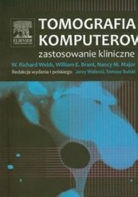 Tomografia komputerowa. Zastosowanie kliniczne