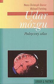 Udar mózgu