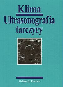 Ultrasonografia tarczycy