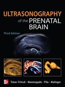 Ultrasonography of the Prenatal  Neonatal Brain 3e