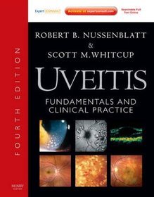 Uveitis 4e