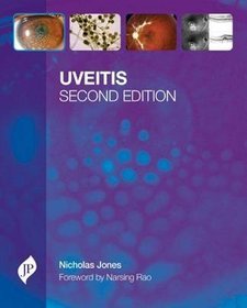 Uveitis