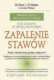Zapalenie stawów