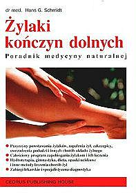 Żylaki kończyn dolnych