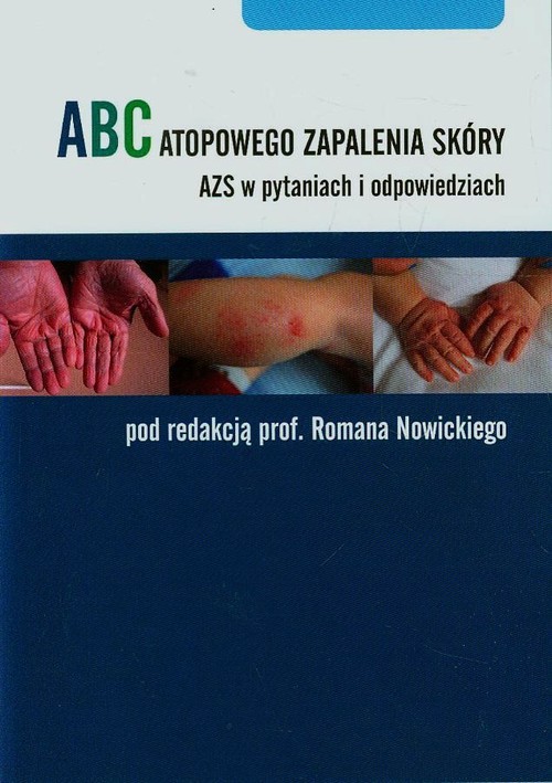ABC atopowego zaplenia skóry. AZS w pytaniach i odpowiedziach
