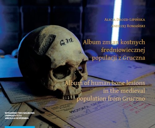Album zmian kostnych średniowiecznej populacji z Gruczna
