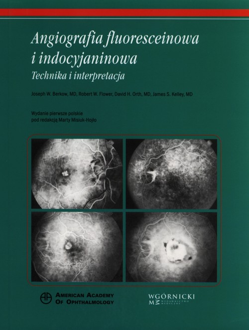 Angiografia fluoresceinowa i indocyjaninowa. Technika i interpretacja