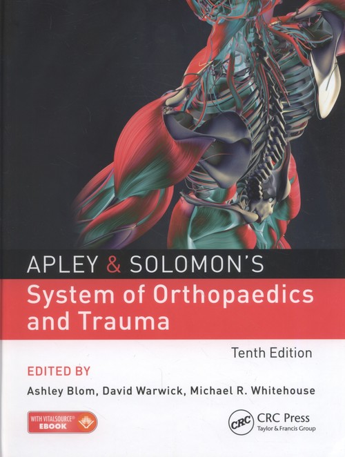 Apley & Solomon's System of Orthopaedics and Trauma