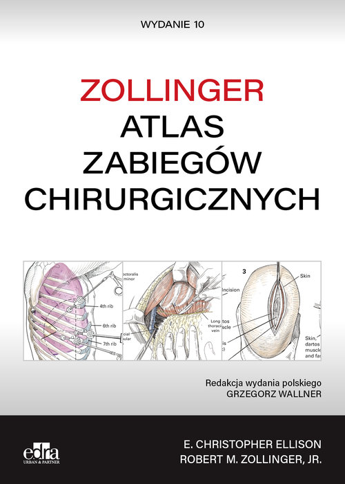 Atlas zabiegów chirurgicznych. Zollinger