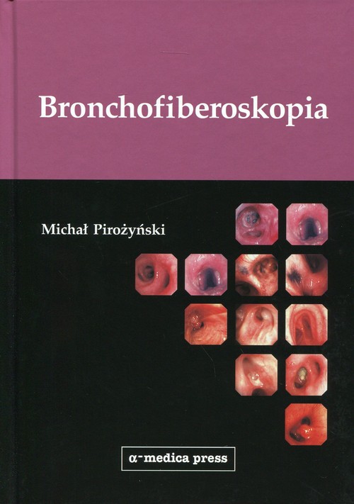 Bronchofiberoskopia