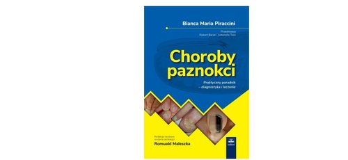 Choroby paznokci Praktyczny poradnik - diagnostyka i leczenie
