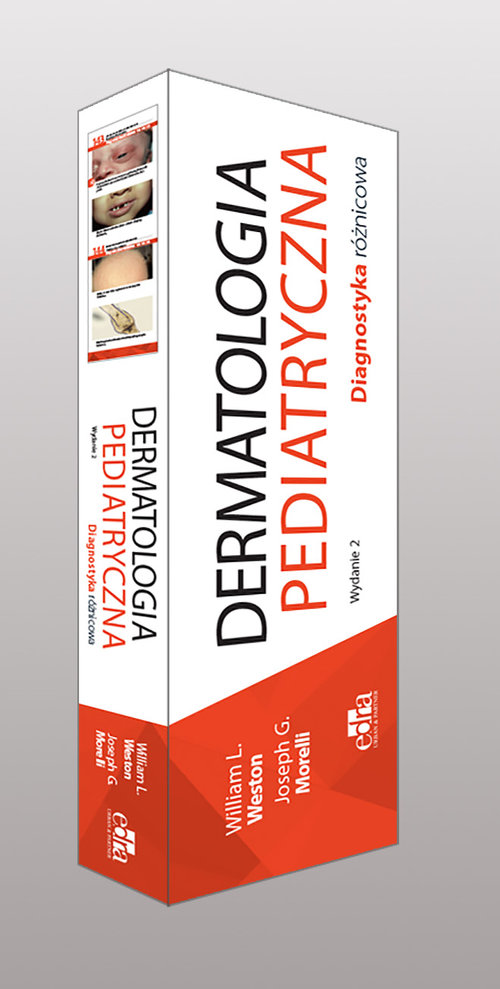 Dermatologia pediatryczna Diagnostyka różnicowa