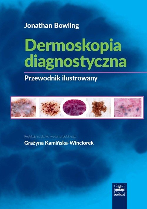 Dermoskopia diagnostyczna Poradnik ilustrowany