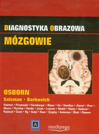 Diagnostyka obrazowa Mózgowie