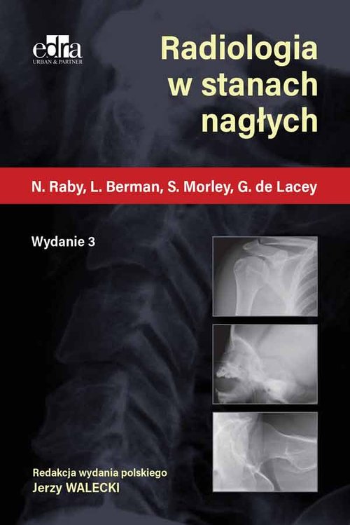 Diagnostyka obrazowa w traumatologii