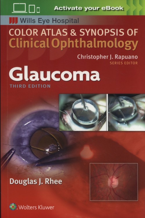 Glaucoma