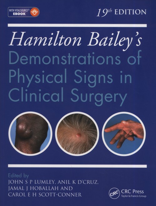 Hamilton Bailey's Physical Signs