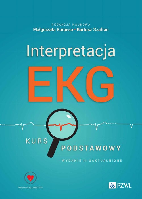 Interpretacja EKG