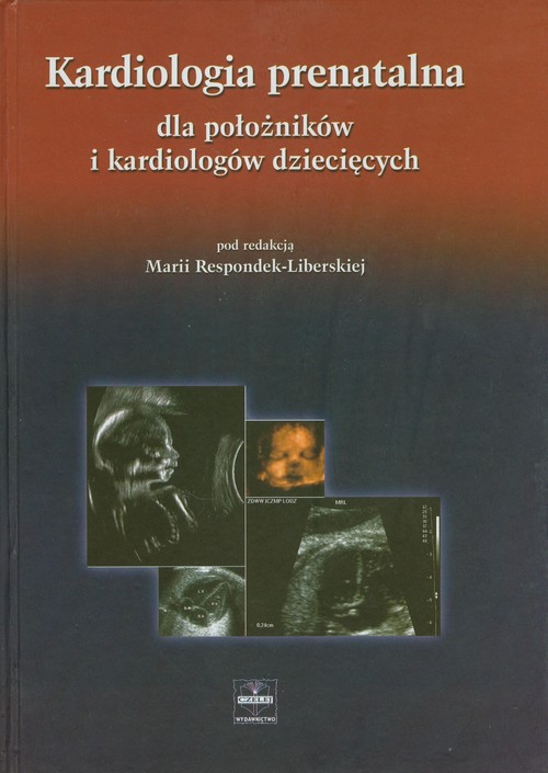 Kardiologia prenatalna dla położników i kardiologów dziecięcych