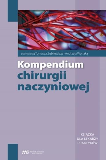 Kompendium chirurgii naczyniowej