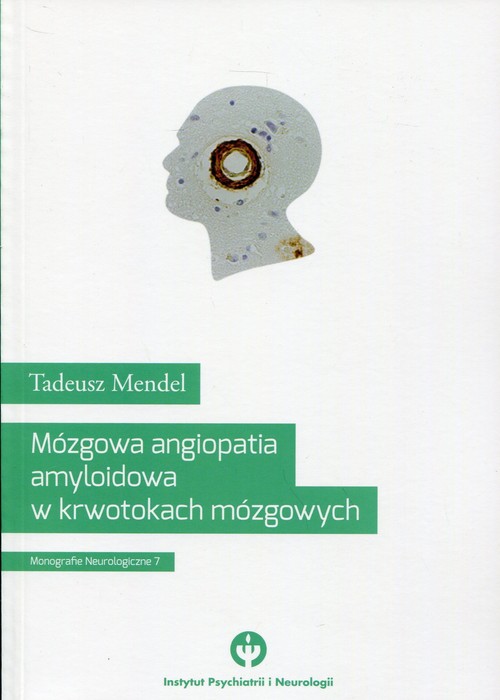Mózgowa angiopatia amyloidowa w krwotokach mózgowych