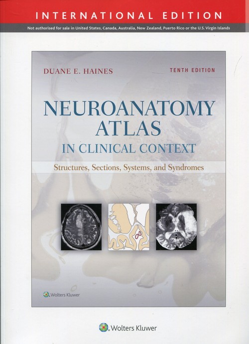 Neuroanatomy Atlas in Clinical Context