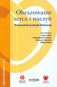 Obrazowanie serca i naczyń z płytą CD
