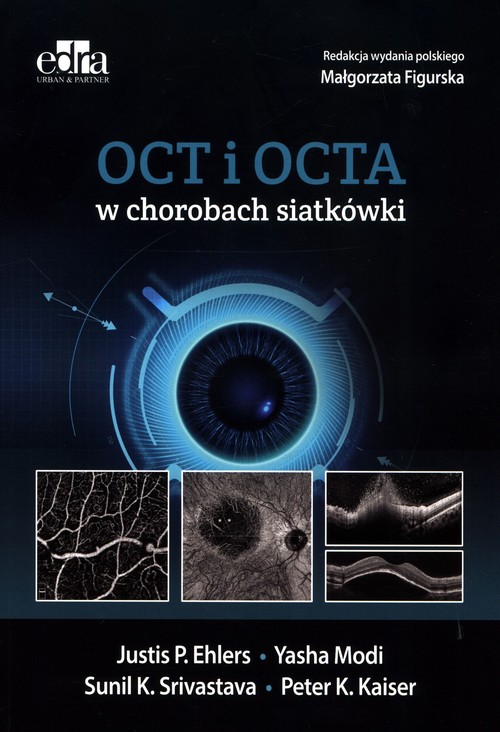 OCT i OCTA w chorobach siatkówki