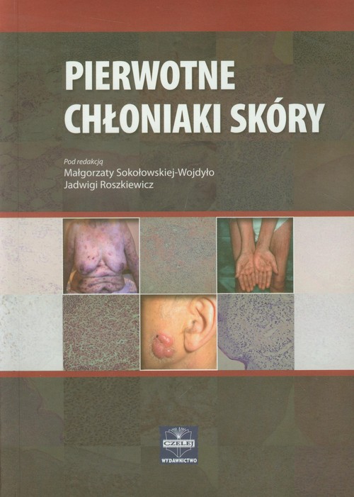 Pierwotne chłoniaki skóry