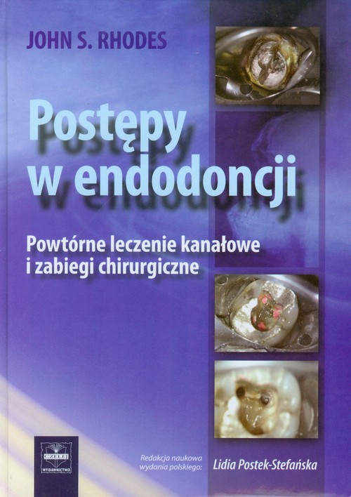 Postępy w endodoncji Powtórne leczenie kanałowe i zabiegi chirurgiczne