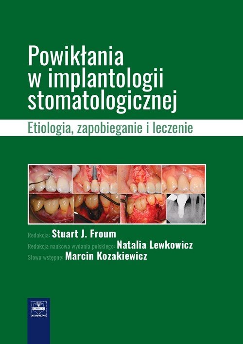 Powikłania w implantologii stomatologicznej.