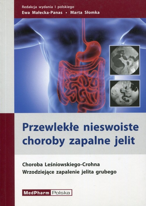Przewlekłe nieswoiste choroby zapalne jelit