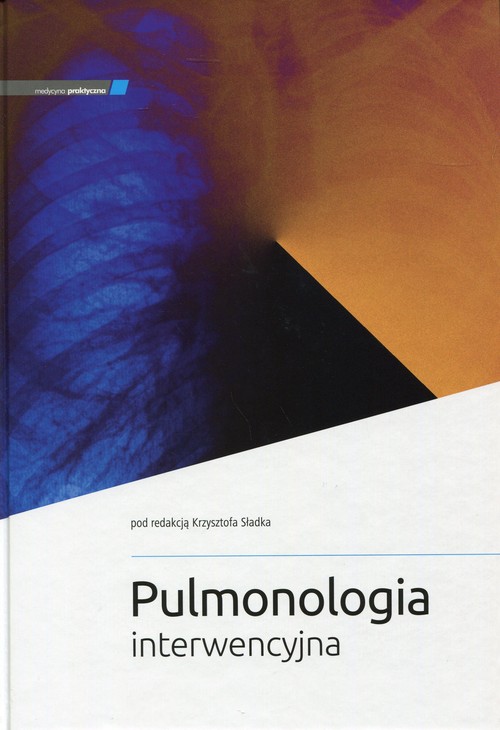 Pulmonologia interwencyjna