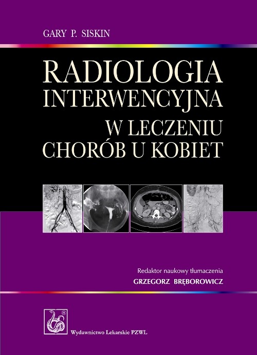 Radiologia interwencyjna w leczeniu chorób u kobiet