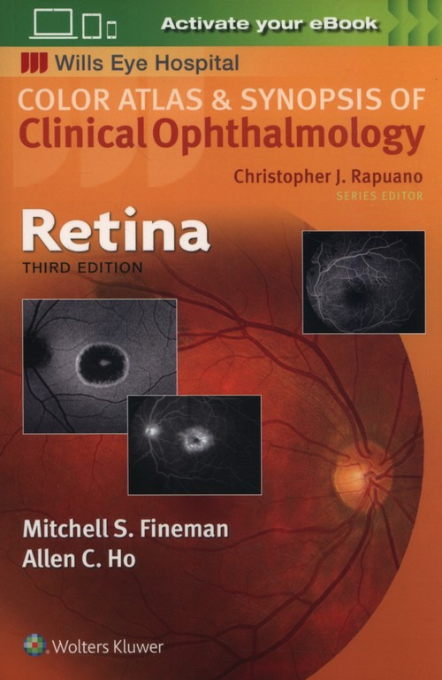 Retina