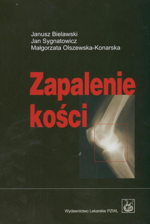 Zapalenie kości