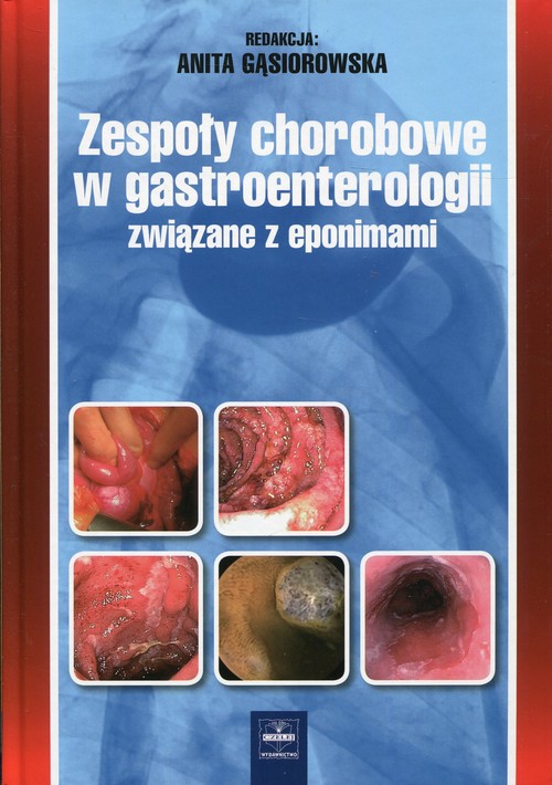 Zespoły chorobowe w gastroenterologii związane z eponimami