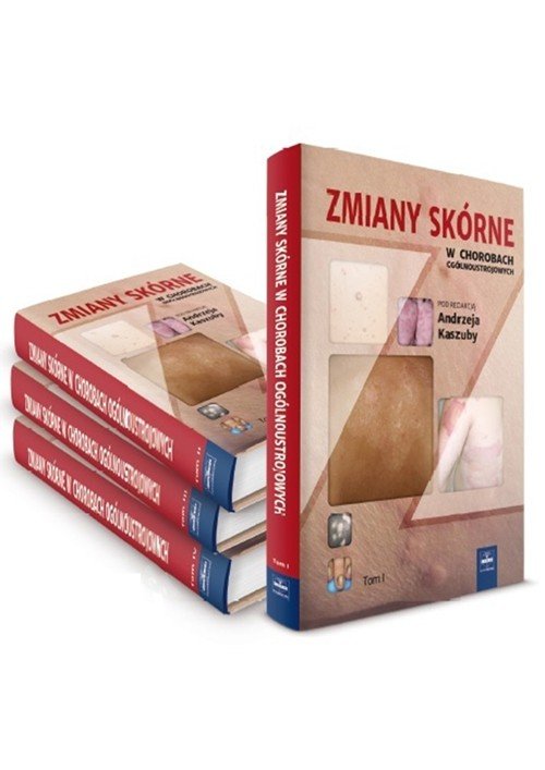 Zmiany skórne w chorobach ogólnoustrojowych Tom 3