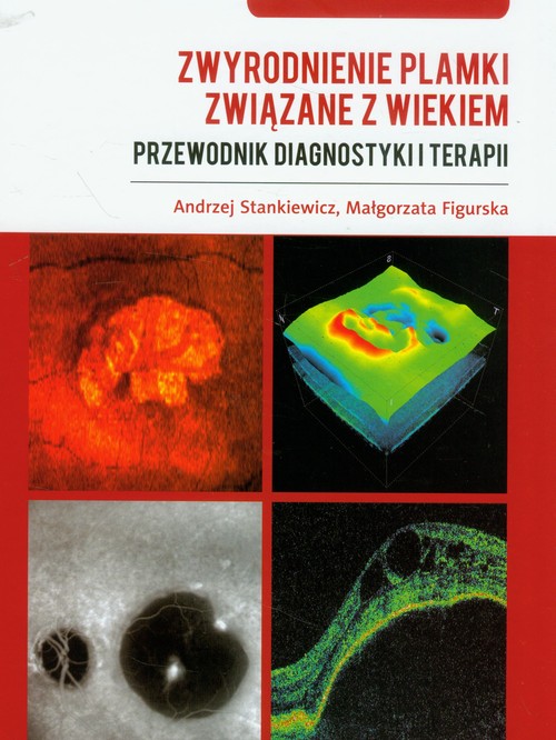 Zwyrodnienie plamki związane z wiekiem - przewodnik diagnostyki i terapii